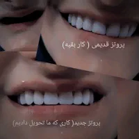 دندانسازی ساخت دندان مصنوعی|خدمات آرایشگری و زیبایی|خرمآباد, |دیوار