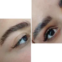لیفت ابرو و مژه