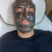 جوان سازی پوست کربن تراپی در کلینیک زیبایی الماس|خدمات آرایشگری و زیبایی|کرج, مهرویلا جنوبی|دیوار