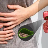 خارج کردن و دفع سنگ صفرا بدون عمل|آرایشی، بهداشتی، درمانی|اهواز, طالقانی|دیوار