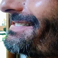 لابراتوار دندانسازی های دنت|پزشکی|بجنورد, |دیوار