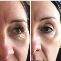 محصولات مراقبت پوستی|آرایشی، بهداشتی، درمانی|کامفیروز, |دیوار