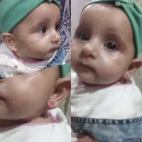 گوشواره طبی|آرایشی، بهداشتی، درمانی|بندر انزلی, میان پشته|دیوار