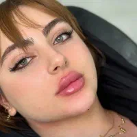 ژل و بوتاکس