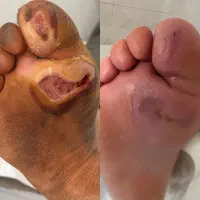 کلینیک تخصصی درمان زخم ( بستر و دیابت) فردوس|خدمات آرایشگری و زیبایی|اصفهان, بهار آزادی|دیوار