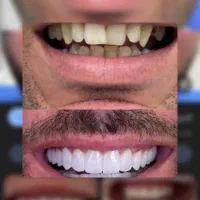 جشنواره بزرگ دندانپزشکی|خدمات آرایشگری و زیبایی|قم, انسجام|دیوار
