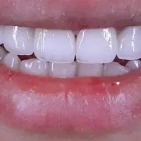 آموزش دستیار دندانپزشکی