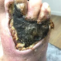 درمان انواع زخم ها با روش های بروز پزشکی|خدمات آرایشگری و زیبایی|تبریز, |دیوار