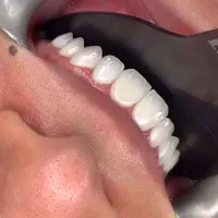 جشنواره خدمات دندانپزشکی با اقساط ۱۵ ماهه + وام|خدمات آرایشگری و زیبایی|تبریز, |دیوار