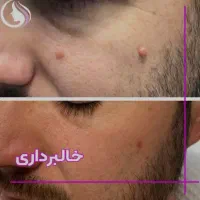خالبرداری