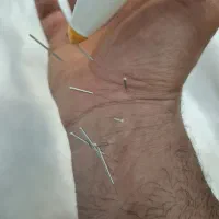 ماساژ ریلکسی صورت سنگ داغ طب سوزنی حجامت و . . .|خدمات زیبایی و سلامت|تهران, طرشت|دیوار