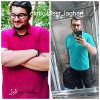 لاغری صد در صد تضمینی با دستگاه بدون عمل جراحی|خدمات آرایشگری و زیبایی|اهواز, پادادشهر|دیوار