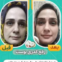 کرم ژل رویال صد در صد تضمینی|آرایشی، بهداشتی، درمانی|شیراز, حافظیه|دیوار