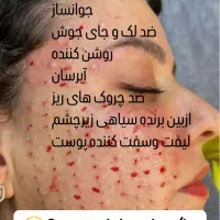 پی آرپی آمریکا۶۵۰ ژل ۷۵۰ بوتاکس ۷۹۰بوتاکس زیربغل|خدمات آرایشگری و زیبایی|اصفهان, خلجا|دیوار