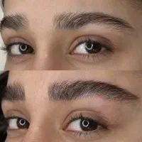 میکروبلیدینگ