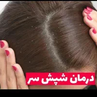 درمان شپش سر در یک تایم محدود