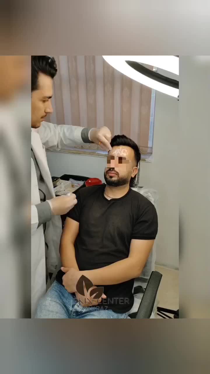 جشنواره تخفیف بوتاکس/ژل/آنزیم‌بینی/فیلرلب/فولفیس|خدمات آرایشگری و زیبایی|شیراز, زرهی|دیوار