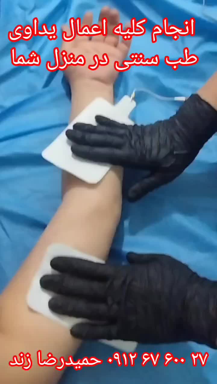حجامت فصد زالو بادکش طب سوزنی فیزیوتراپی|خدمات آرایشگری و زیبایی|تهران, ایران|دیوار