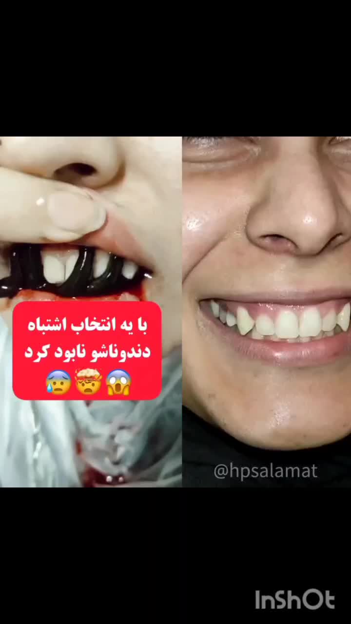 زالو درمانی تخصصی فصد حجامت پی آر پی جوانسازی فیلر|خدمات آرایشگری و زیبایی|اصفهان, محمودآباد|دیوار