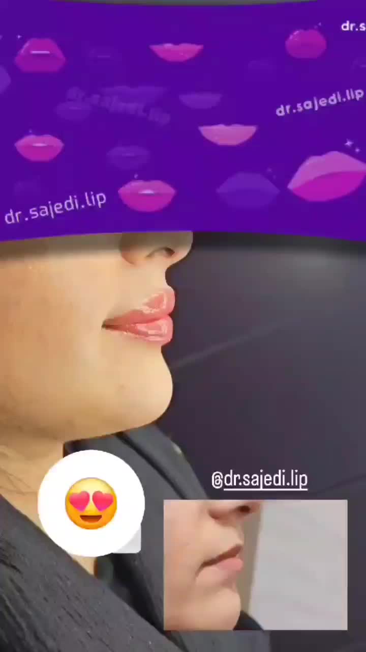 لب / ژل لب / روسی و طبیعی|خدمات آرایشگری و زیبایی|شوش, |دیوار