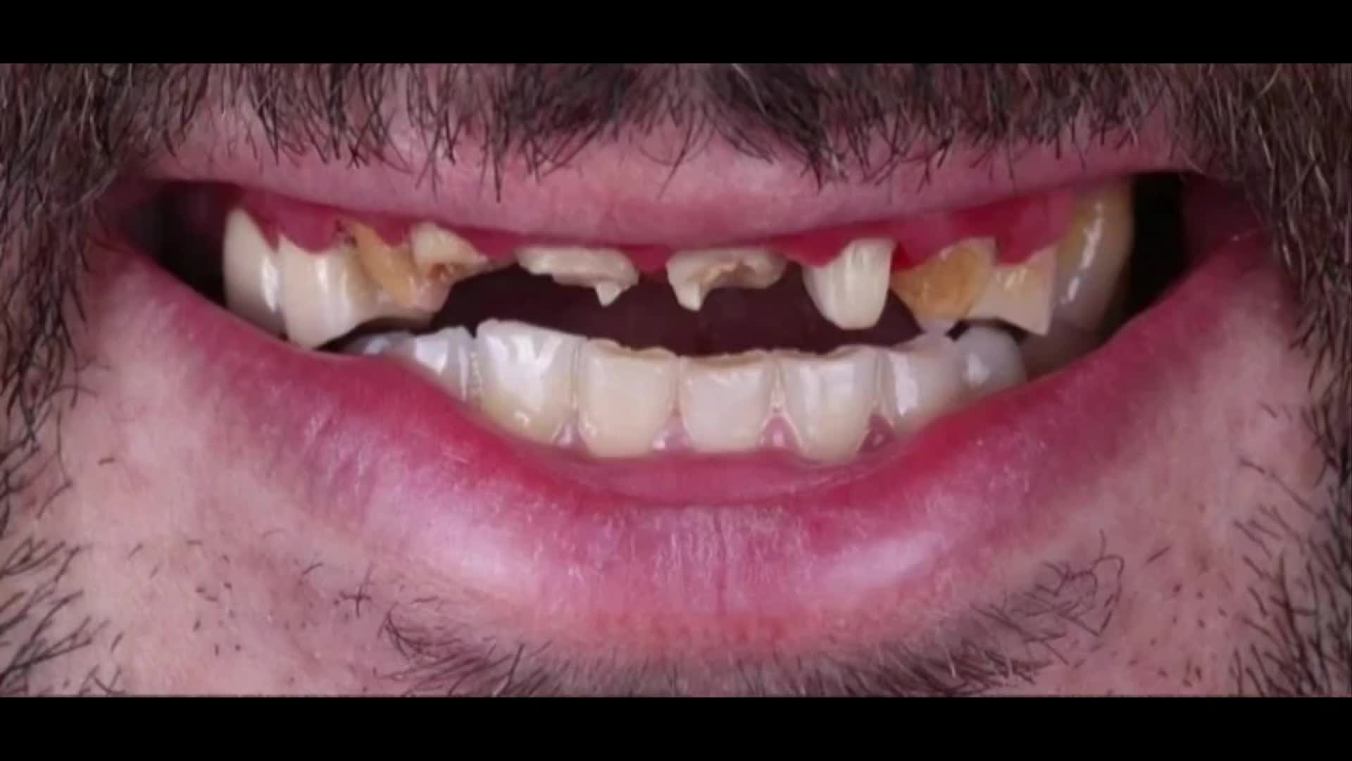 کلیه خدمات دهان دندان ایمپلنت کامپوزیت|خدمات آرایشگری و زیبایی|رشت, گلسار|دیوار