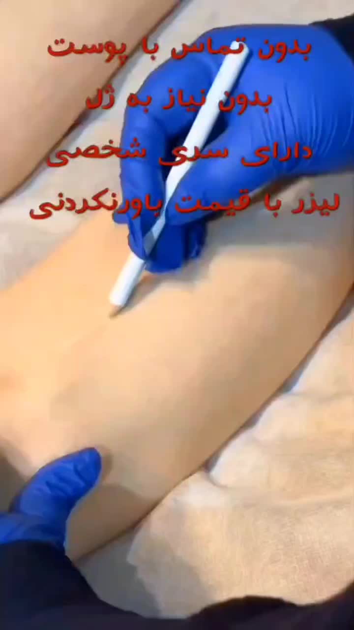 جشنواره لیزر الکساندرایت شاتی غیر تماسی|خدمات آرایشگری و زیبایی|قزوین, |دیوار