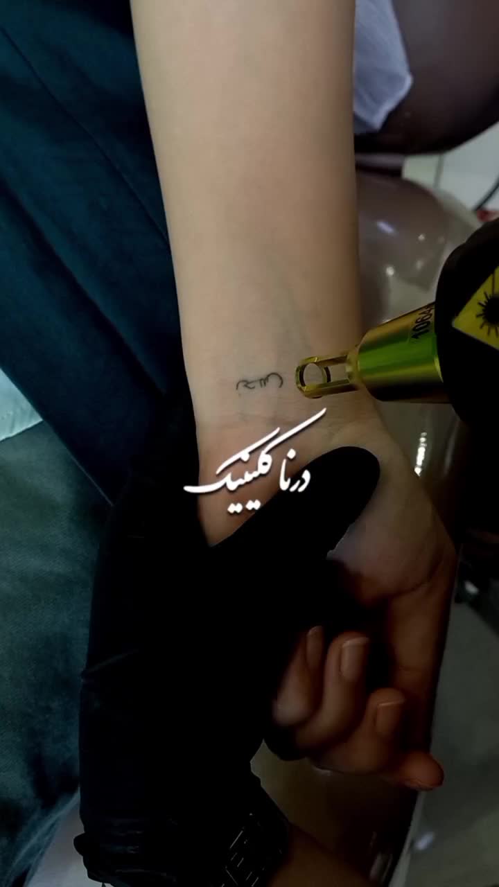 پاک کردن خالکوبی، تتو بدن و ابرو با لیزر کیوسوئیچ|خدمات آرایشگری و زیبایی|ارومیه, |دیوار