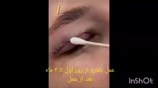 بلفارو پلاستی حرفه ای|خدمات آرایشگری و زیبایی|تهران, بلوار کشاورز|دیوار