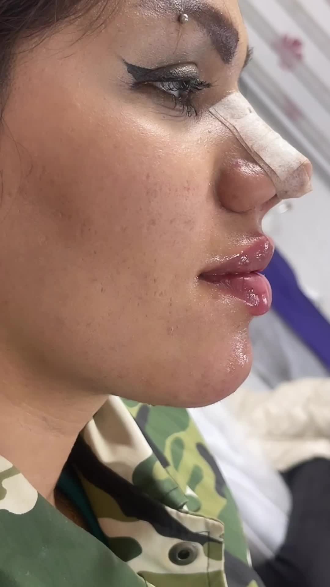 ژل لب تزریق ژل بوتاکس ژل گونه چانه زاویه فک|خدمات آرایشگری و زیبایی|اصفهان, سعادت‌آباد|دیوار