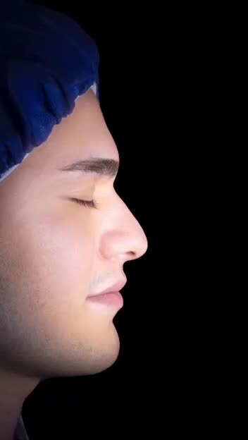 جراحی و عمل بینی/ لیفت صورت در کرج و تهران|خدمات آرایشگری و زیبایی|کرج, جهان‌شهر|دیوار