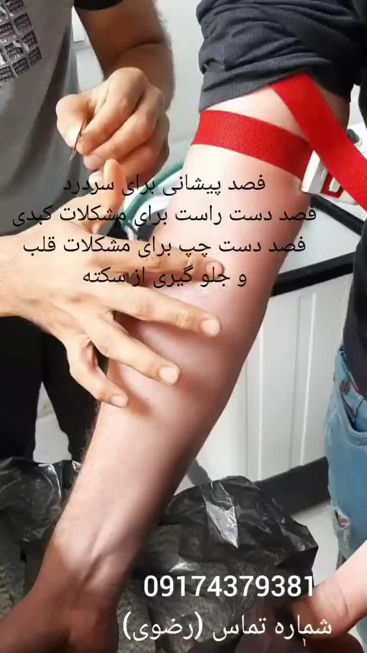 فصد و حجامت های تخصصی دیسک و سیاتیک|خدمات آرایشگری و زیبایی|قم, بلوار ۱۵ خرداد|دیوار