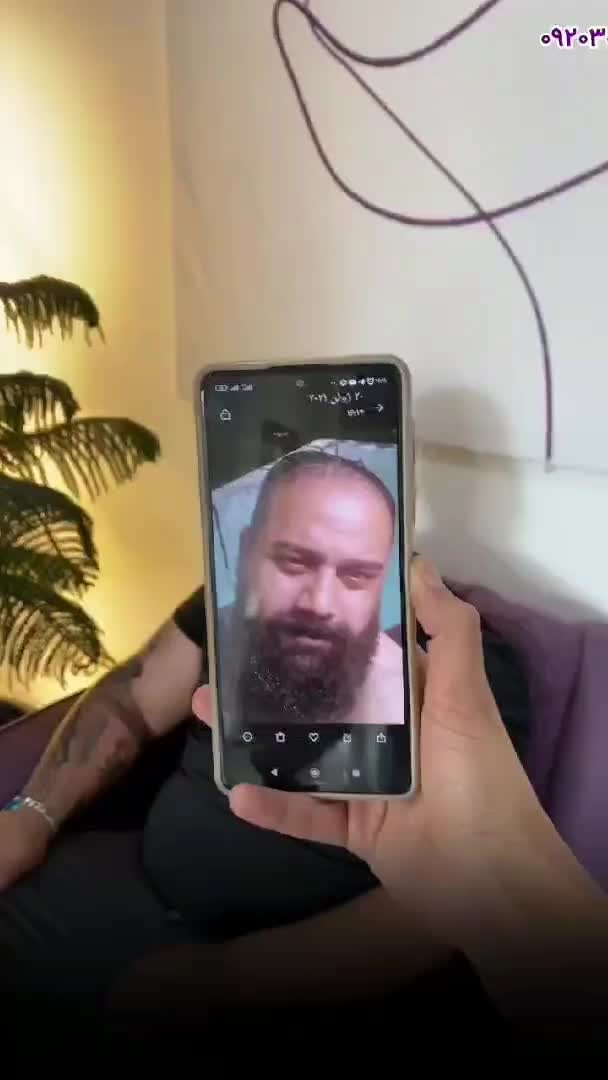 کاشت مو ابرو و ریش تارکوب|خدمات آرایشگری و زیبایی|کرج, عظیمیه|دیوار