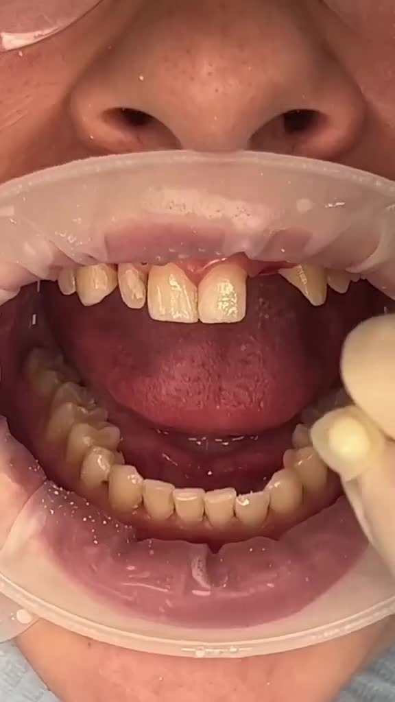 اطفال و نوجوان دندانپزشککی|خدمات آرایشگری و زیبایی|قم, زنبیل آباد|دیوار
