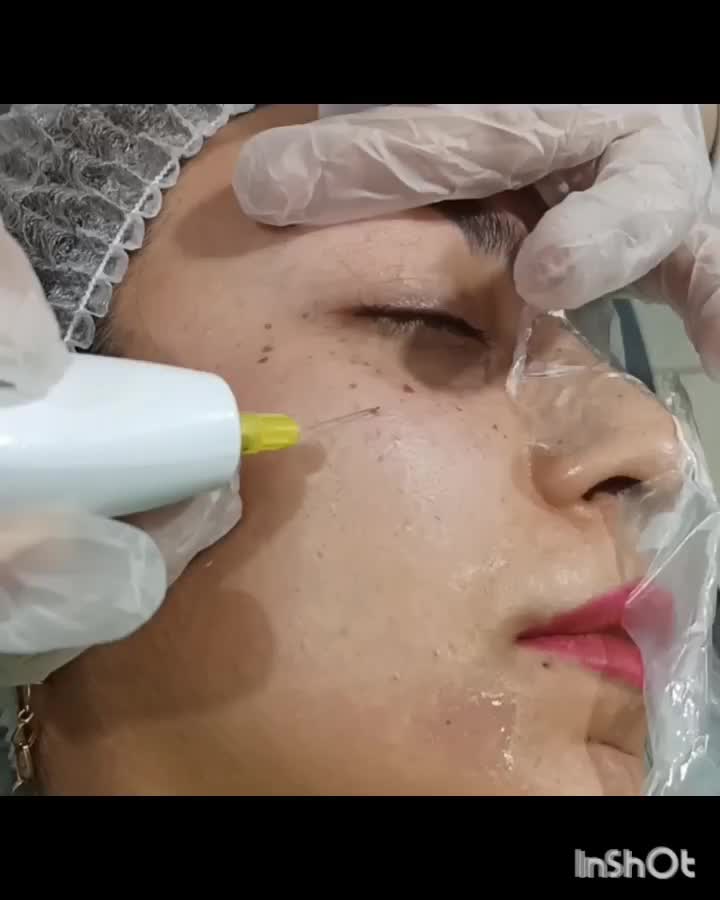ازبین بردن کک ومک تضمینی در یک جلسه|خدمات آرایشگری و زیبایی|گالیکش, |دیوار