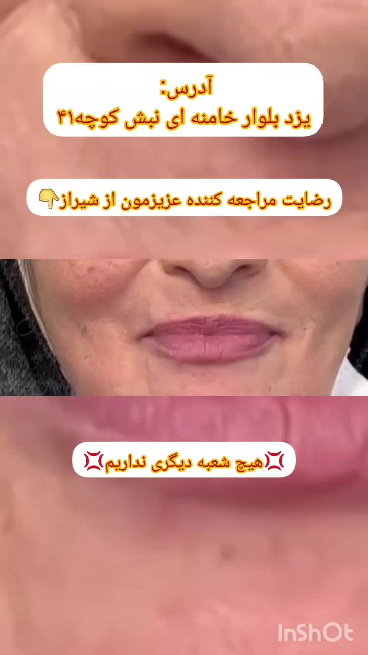 فلکسیبل دَندان مَصنوعی تکه ای ژله ای دَنداًنسازی|خدمات آرایشگری و زیبایی|یزد, |دیوار