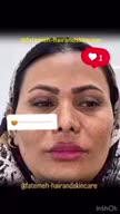 آموزش اسکالپ کف سر و فشیال پوست و کراتین ابریشمی|خدمات آموزشی|خمینی‌شهر, |دیوار