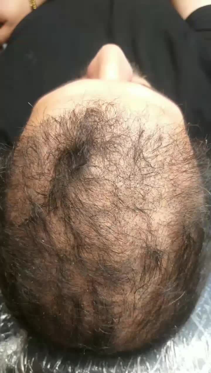 میکرواسکالپ / اسکالپ جایگزین کاشت مو تضمینی|خدمات آرایشگری و زیبایی|مشهد, شهید فرامرز عباسی|دیوار