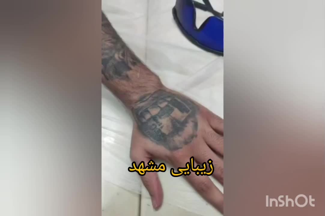 کلینیک تخصصی پاک کردن تتو با لیزر تضمینی/ریمو ابرو|خدمات آرایشگری و زیبایی|مشهد, کوثر|دیوار