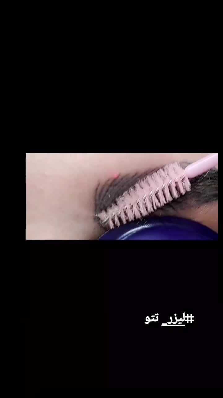 حذف تتو|خدمات آرایشگری و زیبایی|قم, صدوق|دیوار