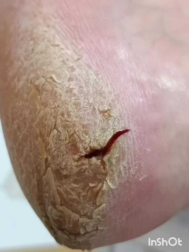 پدیکور و کفسابی تضمینی با پارافین تراپی|خدمات آرایشگری و زیبایی|شاهین‌شهر, عطار|دیوار