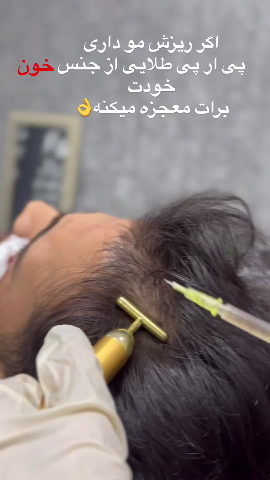 ژل، بوتاکس،آنزیم،مزوتراپی پی ار پی،فیلر بادی|خدمات آرایشگری و زیبایی|اهواز, گلستان|دیوار