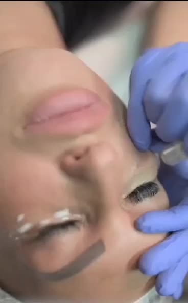 فیشیال (پاکسازی) خالبرداری و پلاسما صورت|خدمات آرایشگری و زیبایی|کوهدشت, |دیوار