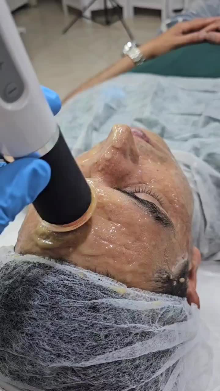 پاکسازی تخصصی پوست آقایان (کاشمر)|خدمات آرایشگری و زیبایی|کاشمر, |دیوار