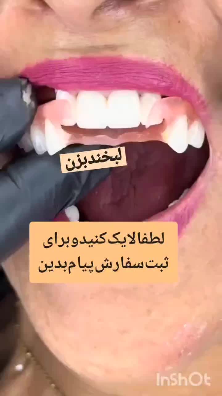 دندانسازی ساخت دندان مصنوعی|خدمات آرایشگری و زیبایی|خرمآباد, |دیوار