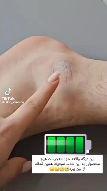 اسپری های پدیکور پا|حراج|اندیمشک, |دیوار