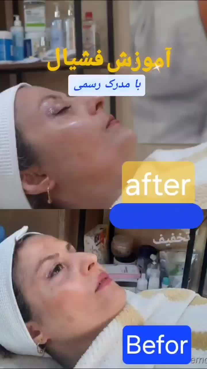 تخفیف50٪ آموزش فیشیال با مدرک رسمی|خدمات آموزشی|کرج, عظیمیه|دیوار