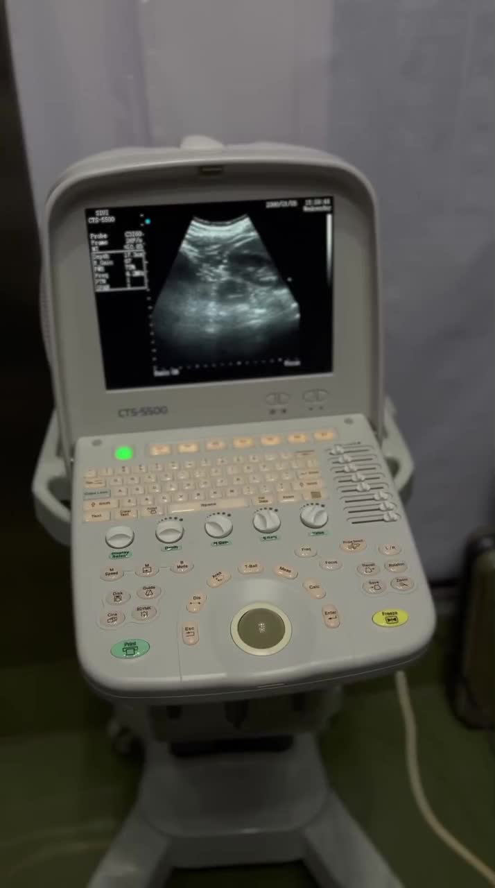 سونوگرافی siui|پزشکی|تهران, جمهوری|دیوار