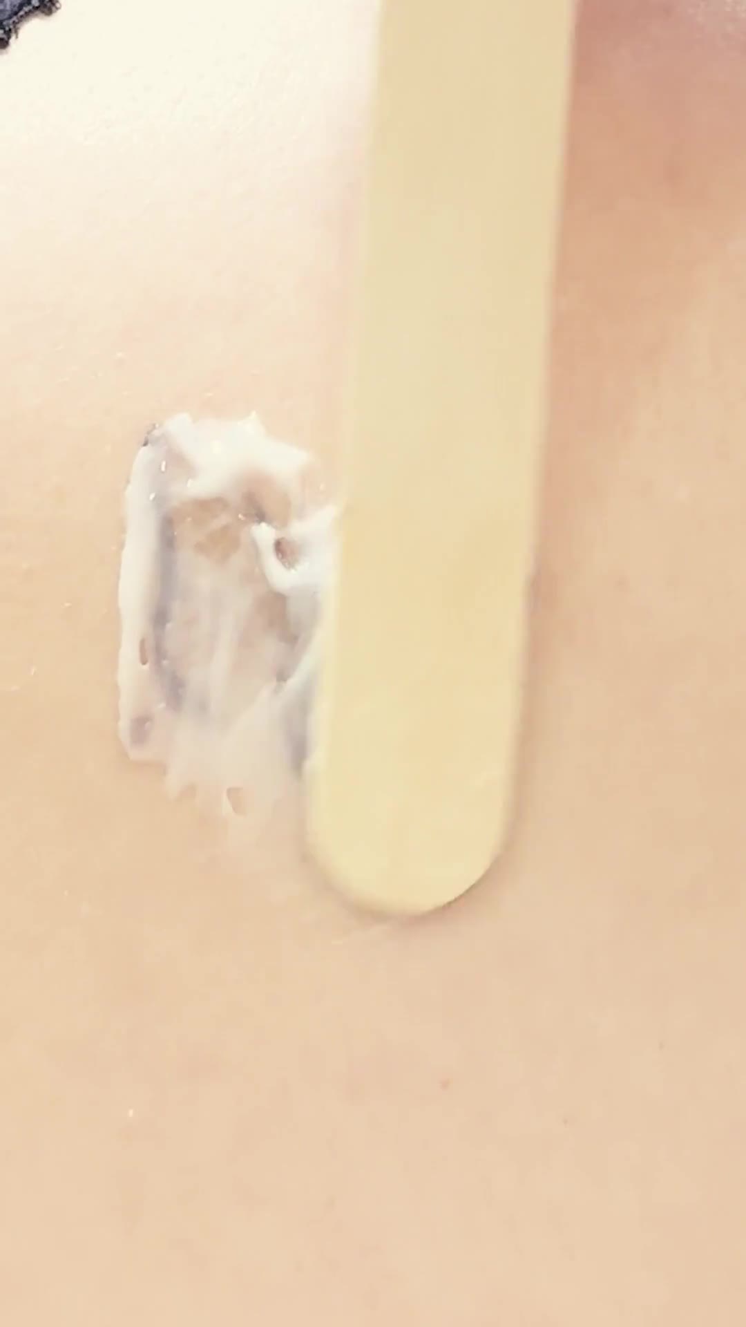 ریموو تتو و کربن تراپی ، جوانسازی پوست ، رفع تیرگی|خدمات آرایشگری و زیبایی|تبریز, |دیوار