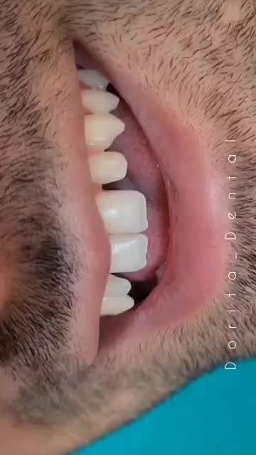 کامپوزیت،ارتودنسی،ایمپلنت|خدمات آرایشگری و زیبایی|بردسکن, |دیوار