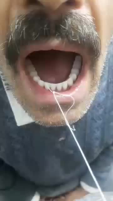 دندان مصنوعی در محل شما با کیفیت تضمینی|خدمات آرایشگری و زیبایی|هشتگرد, شهرک ریحانه|دیوار